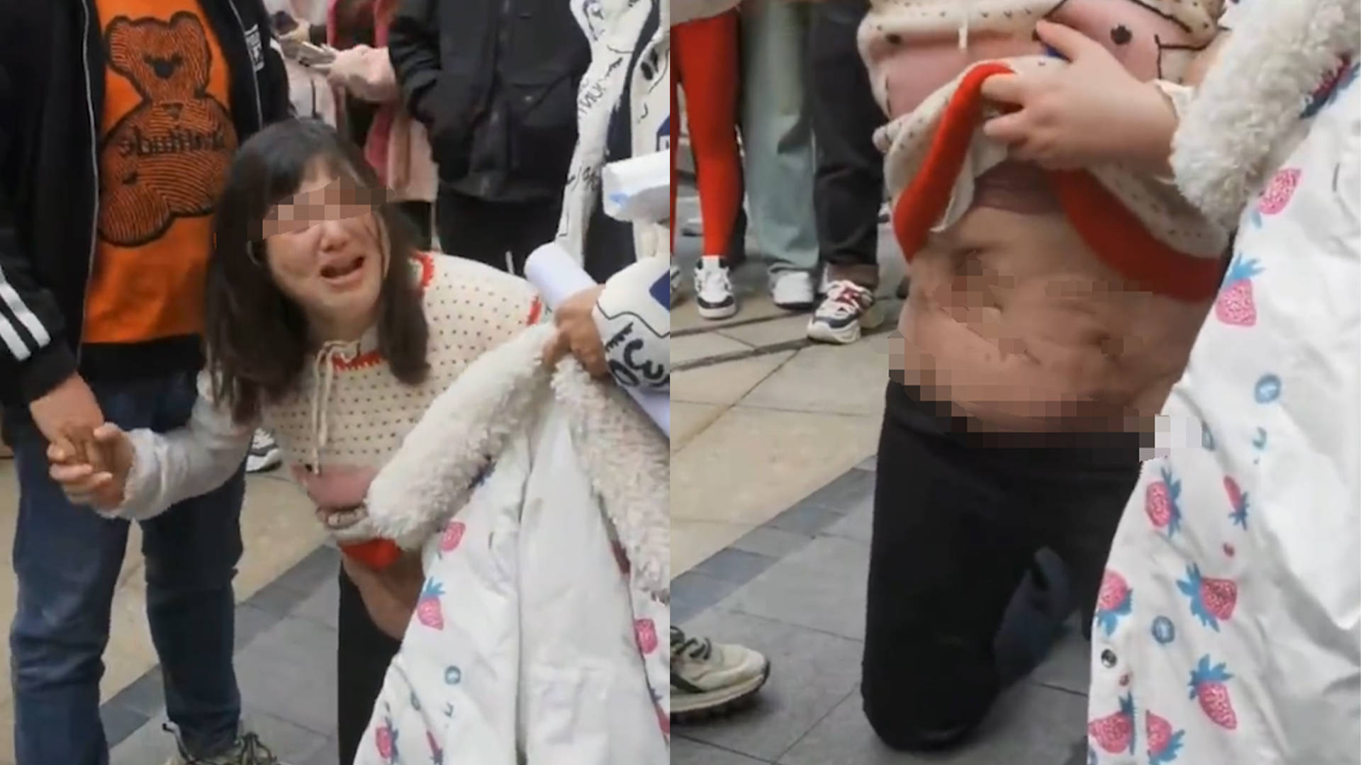 网曝女子被整形机构忽悠,抽脂戳破肠子住进icu,痛哭警示旁人:不要学我