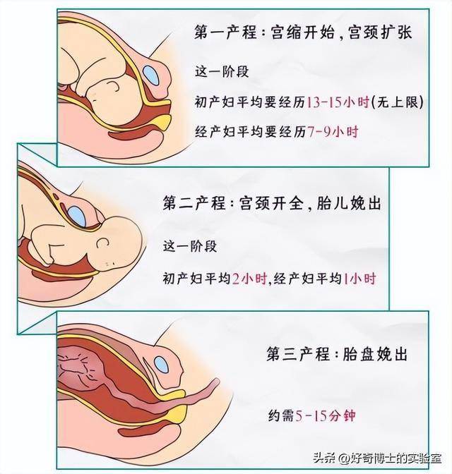 顺产全过程 下面图片