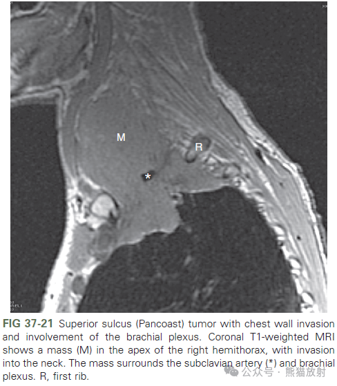 brachial artery图片