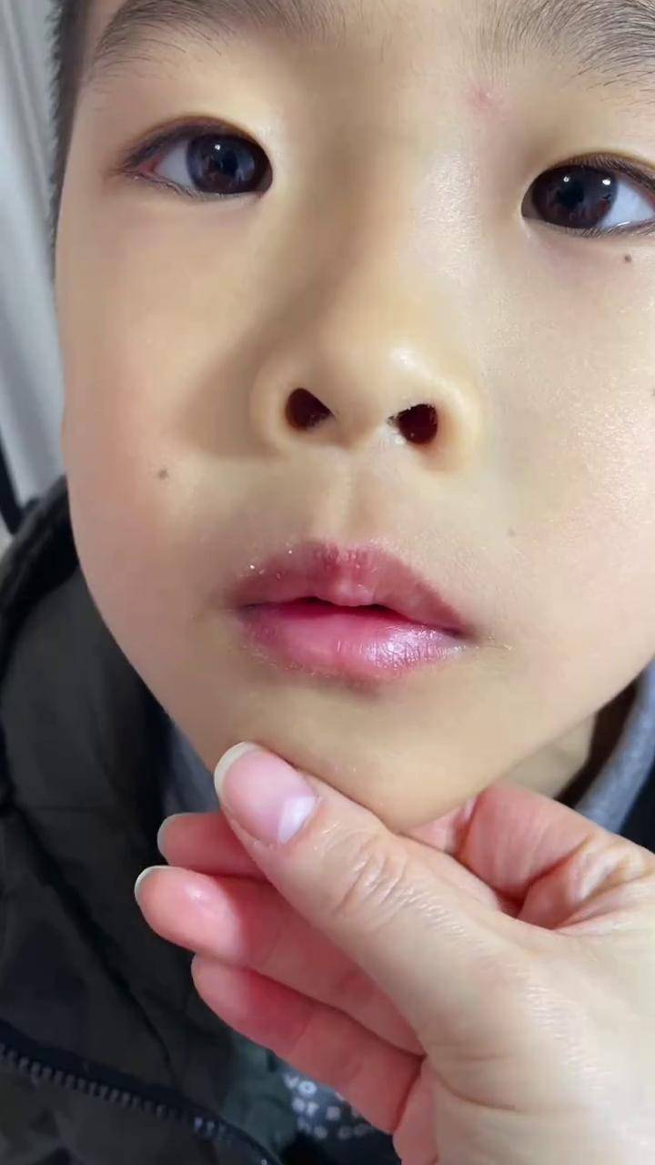 用普通唇膏总舔嘴巴,幸好有这个富瑞卡唇膏#母婴好物 #唇膏#唇炎唇膏