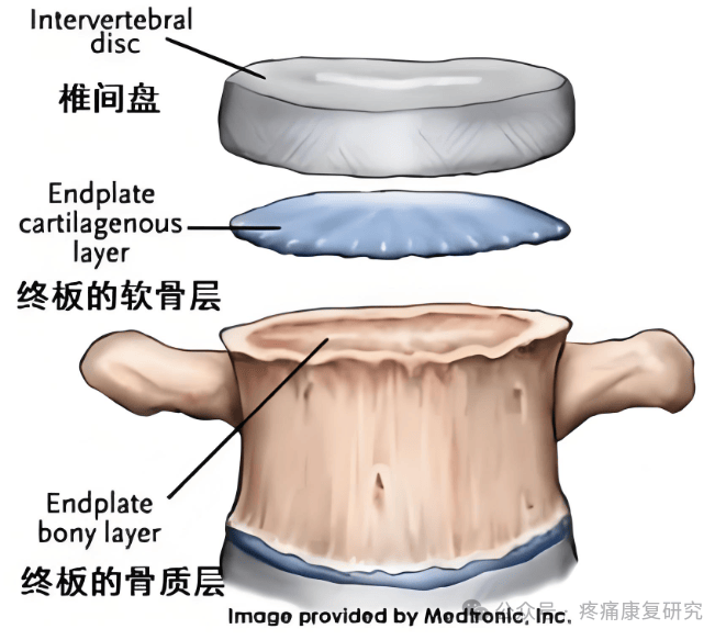 腰痛:椎体终板炎的解剖,分型及mri表现