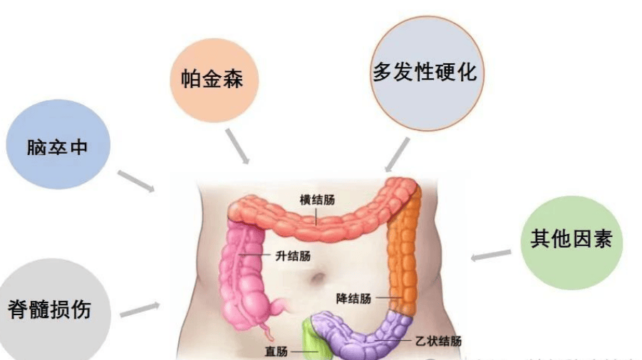 横结肠的作用图片