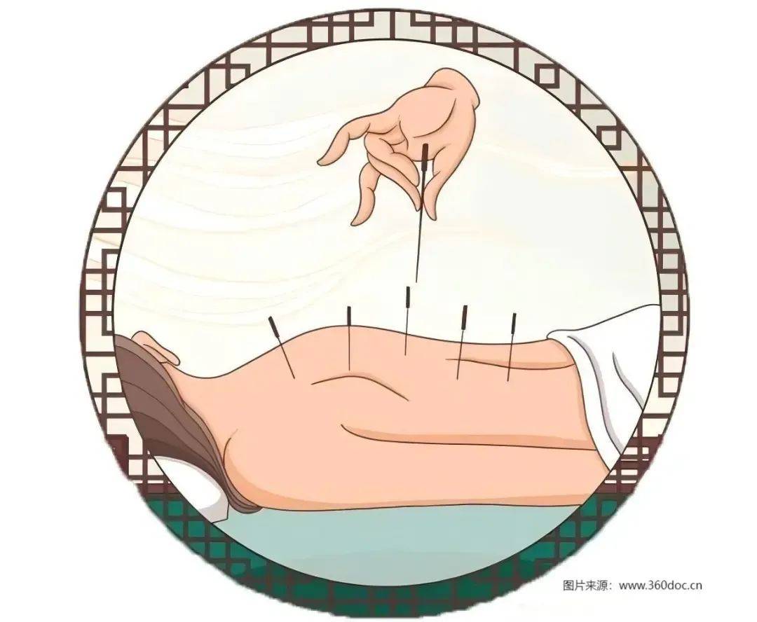 天津针灸推拿专家卢燚带您认识:青少年型姿势性脊柱侧弯