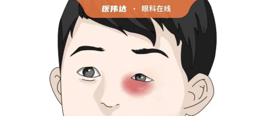 指南速递|中国外伤性感染性眼内炎防治专家共识_微生物_症状_球菌