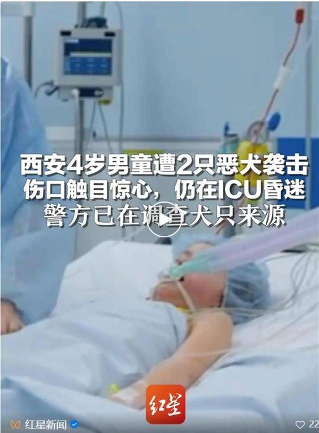 男童脑重伤昏迷图片