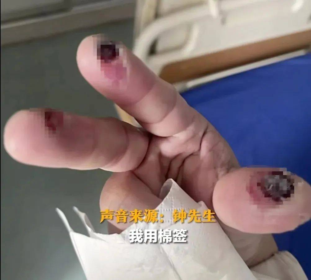 碰到它，手指被腐蚀出黑洞！年前大扫除要注意→
