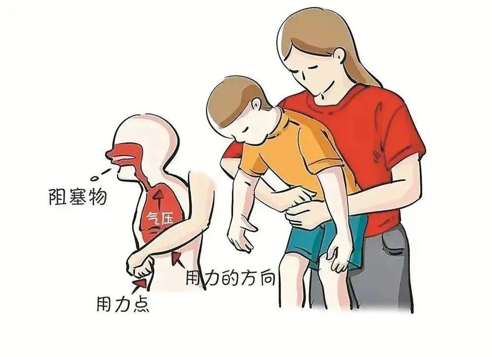 警惕"误吸":食物"走错路",生命在呼救!