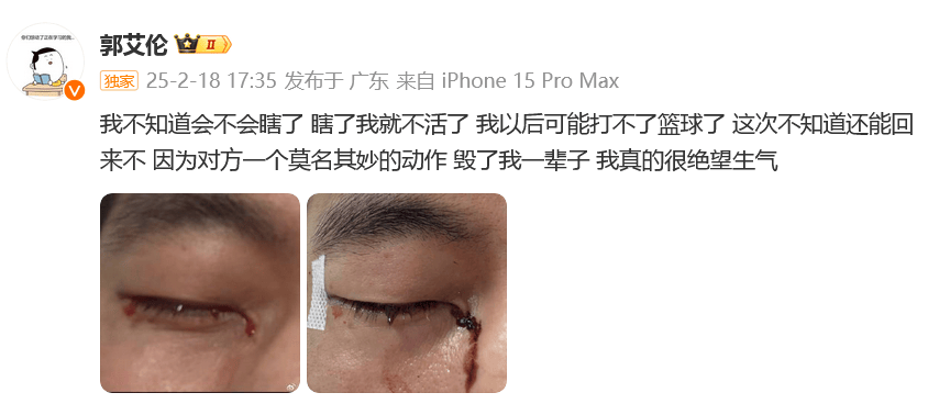 眼睛里缝了40多针！郭艾伦受伤哽咽：“手指直接扎进了眼珠里，以后可能打不了篮球了”