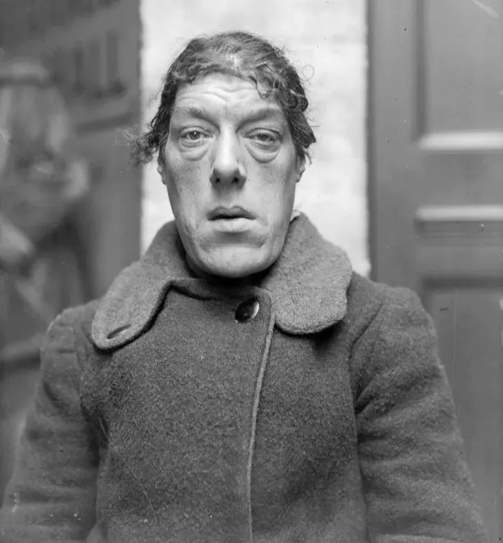 被称世界最丑的女人参加选丑比赛夺冠被马戏团巡回展览受尽侮辱嘲笑只