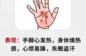 手麻手热手凉，三症状揭秘！中成药三剑客来帮忙！