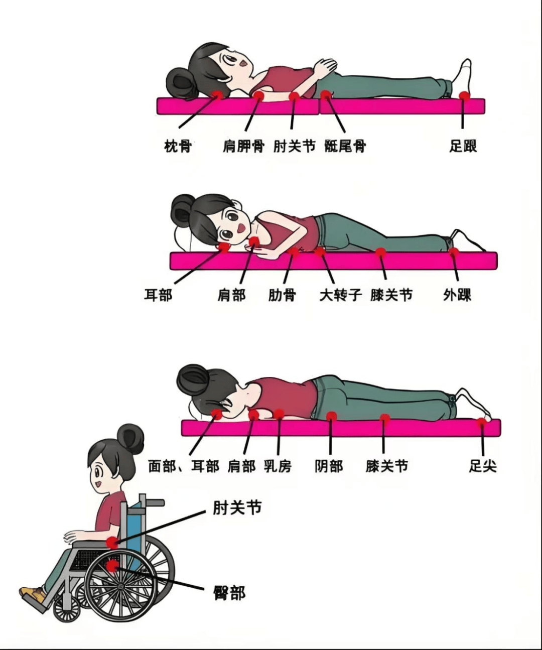 家有卧床老人 快收下这份压疮预防护理指南!