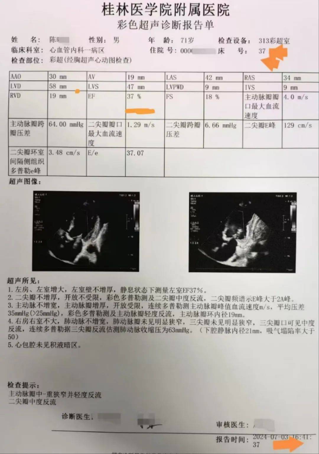 心脏彩超:心电图:患者陈先生因反复气促,咳嗽3年余,加重1周于2024年7