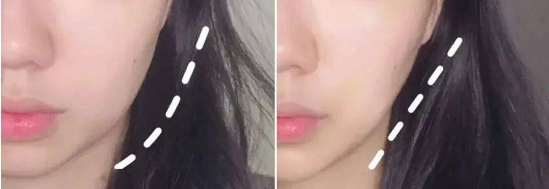 探秘玉米须茶：水肿星人的福音 水肿难题不用愁，玉米须茶解你忧