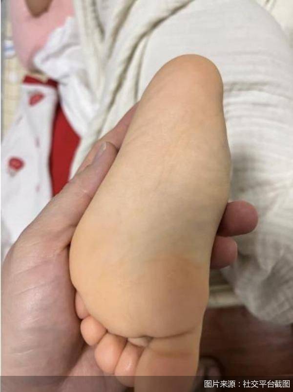 宣称过滤蓝光、医生抨击盲目补坏眼坏肝:谁在神化叶黄素?(图3)