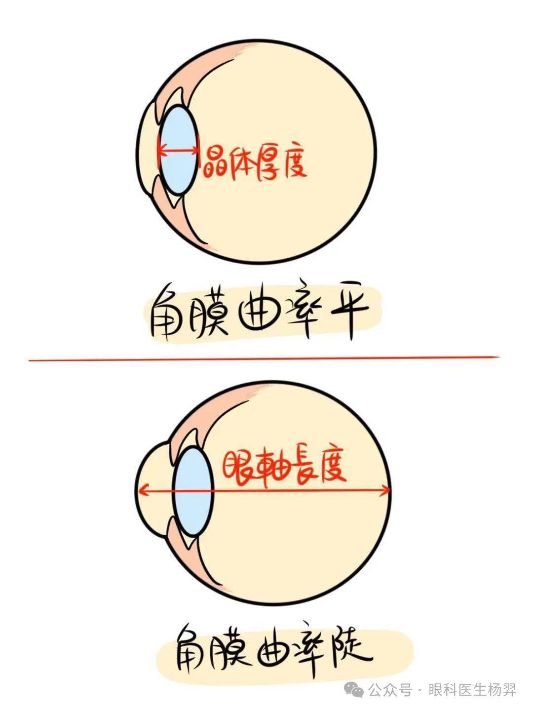 眼科医生杨羿：眼轴、曲率、晶体度数之间到底有啥关系？