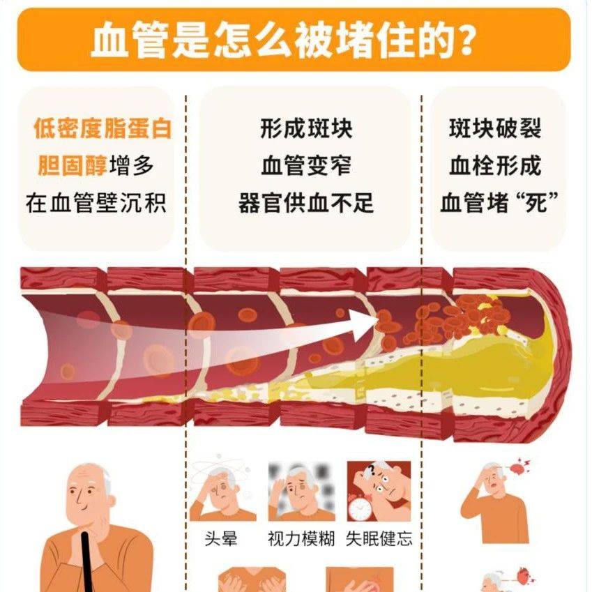 【健康科普】——不是只有胖子才会得高血脂!_胆固醇_药物_食物