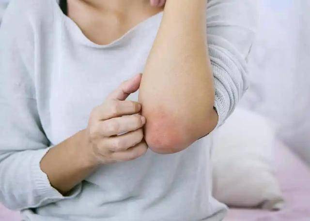 皮肤小毛病竟暗示大肾脏问题，你知道吗？