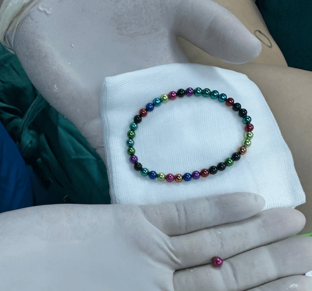 有吃了磁力珠排出来的吗_如果吃了磁力珠几天有反应 有吃了磁力珠倾轧来的吗_假如吃了磁力珠几天有反应（如果吃了磁力珠几天有反应） 磁力资讯