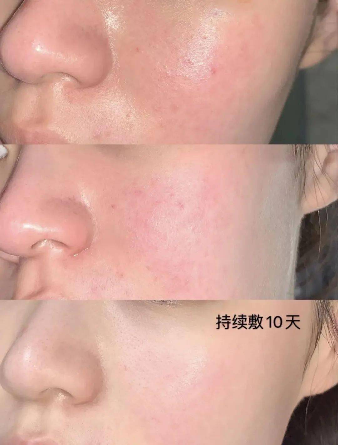 FPN保加利亚玫瑰纯露，补水焕亮一步到位！ 姐妹们必看！FPN保加利亚玫瑰纯露，让肌肤喝饱水！