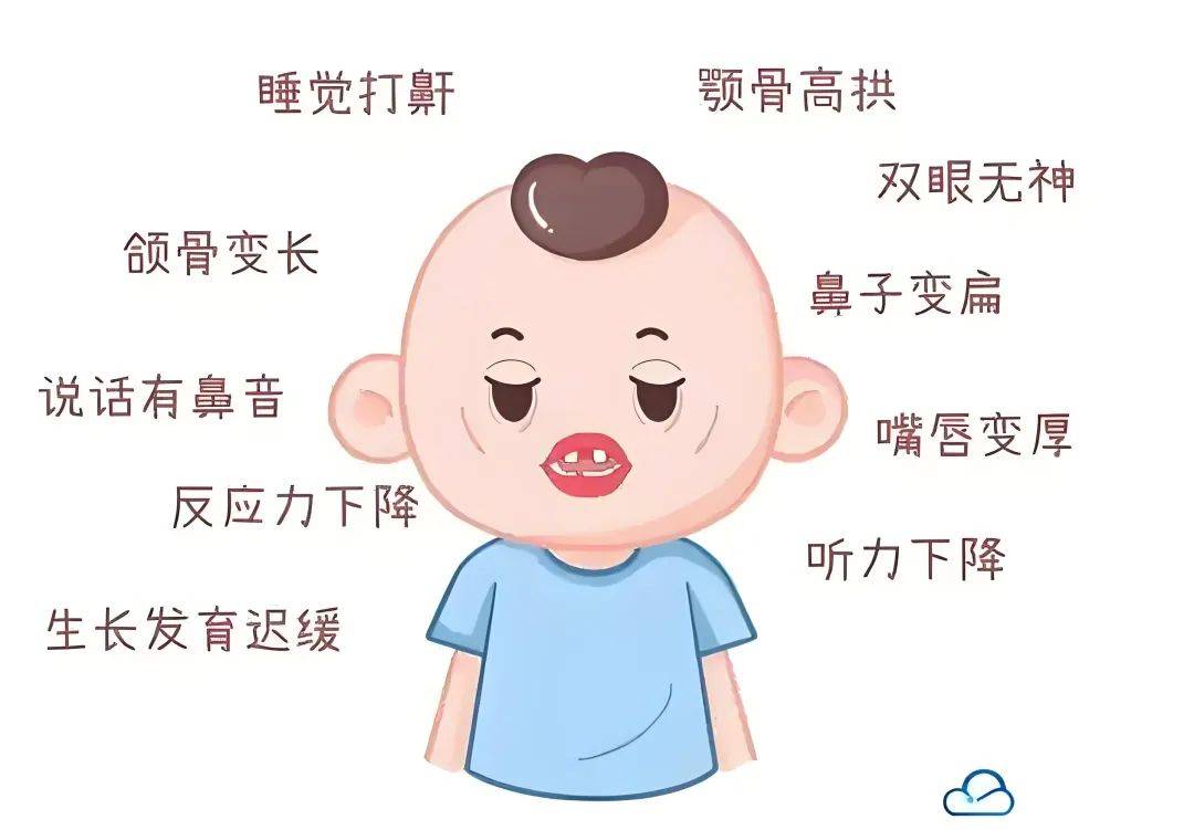 孩子打鼾、张口呼吸、越长越丑?重庆仁品医院：别把腺样体肥大拖成“颜值与智力杀手”