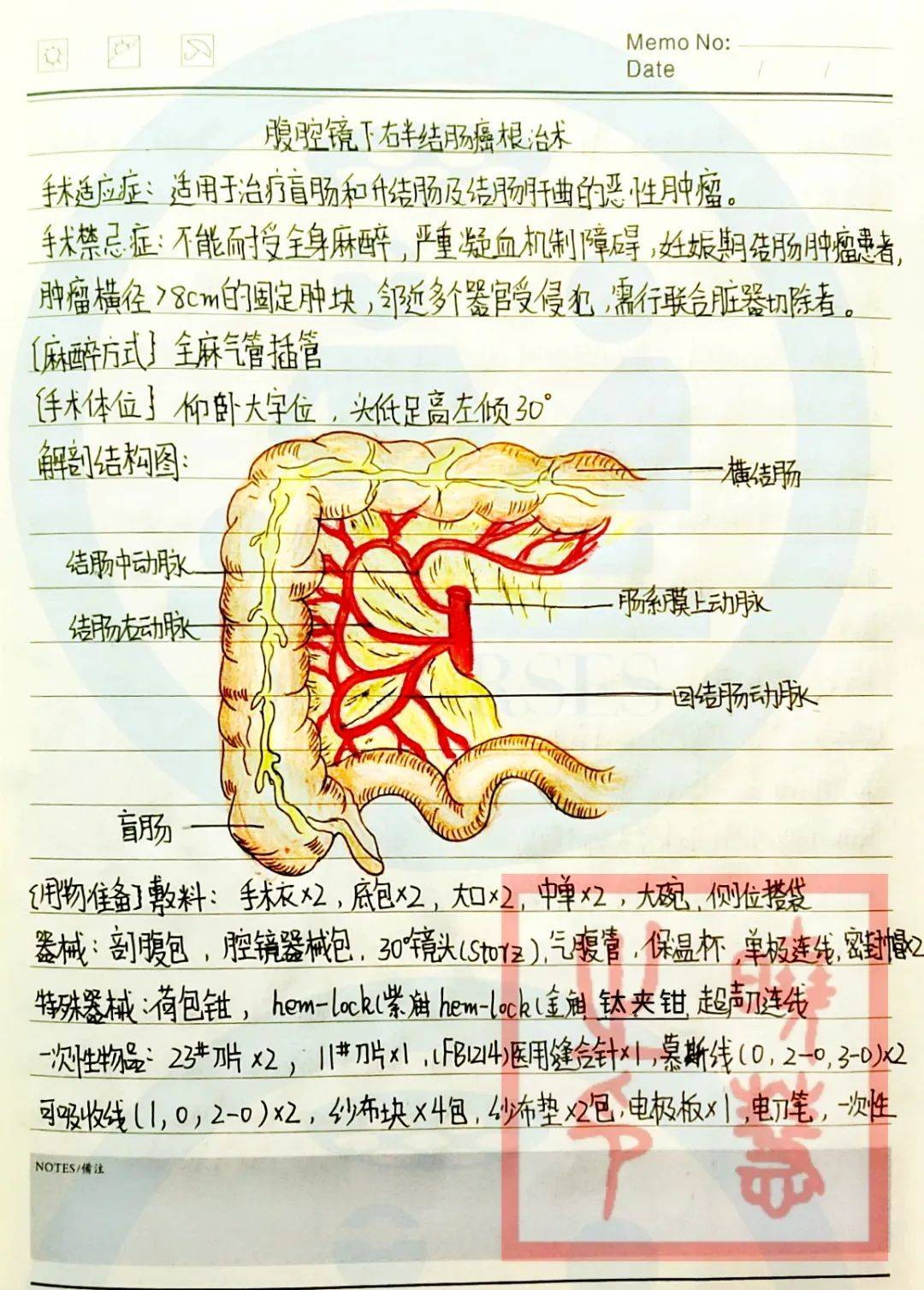 过目不忘的手术笔记 i 腹腔镜下右半结肠癌根治术