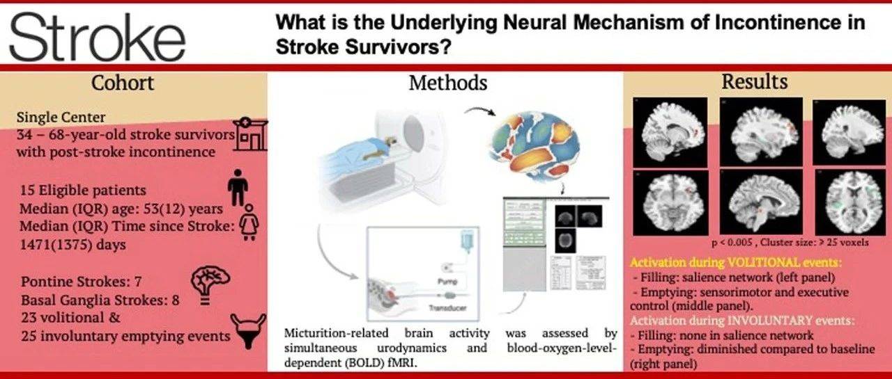 学术动态 | Stroke报道揭示脑卒中后尿失禁的神经机制 为干预突显网络的疗法奠定基础_幸存者_膀胱_患者