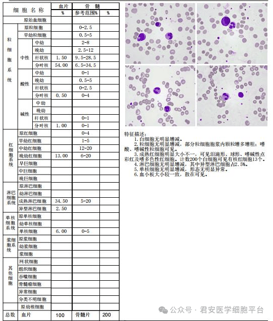 8.骨髓细胞学检查9.骨髓流式细胞学检查10. 红斑狼疮细胞检查，找到红斑狼