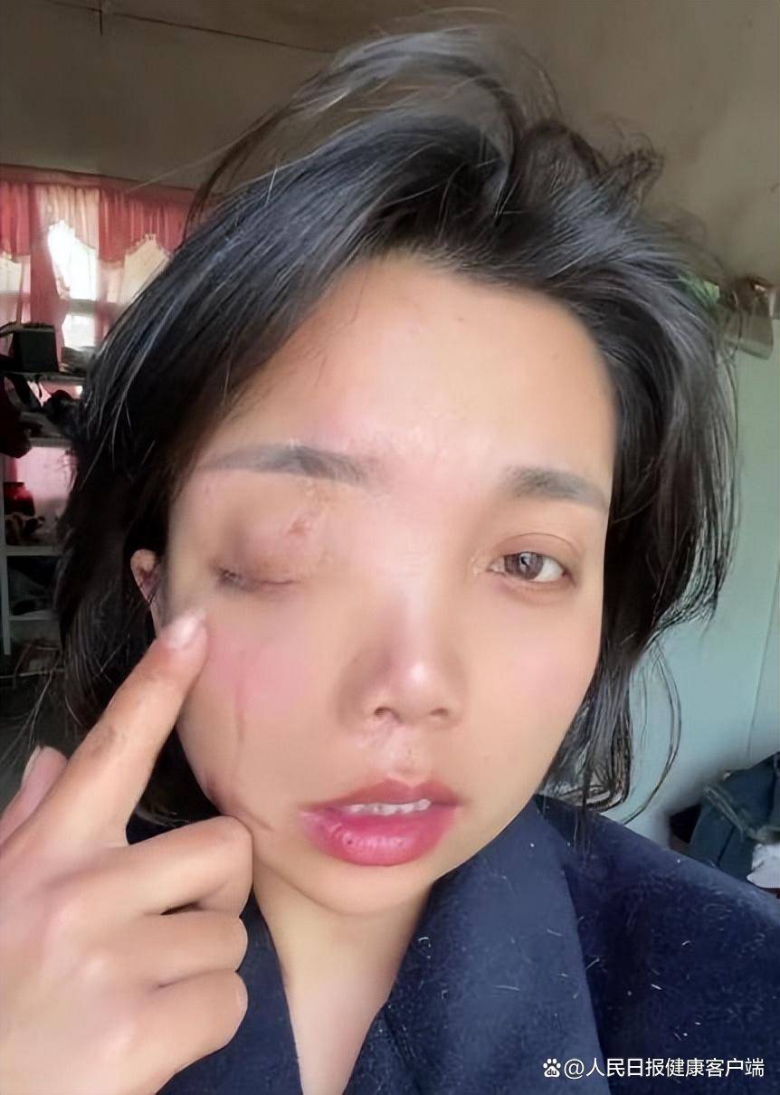 单眼失明的残疾证书是否下降了?应要求雇主提