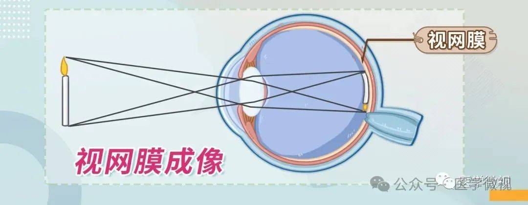 视力和模糊观点的丧失会使老花眼恶化吗？它也
