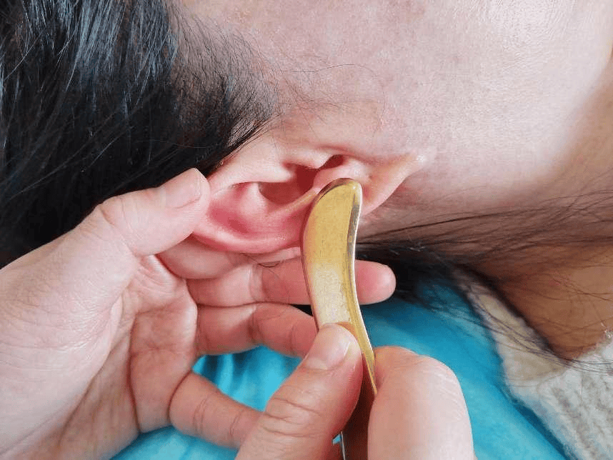 刮痧_考生_耳穴