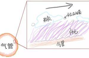 剧烈咳嗽、气道阻塞...「痰栓」虽小,隐患却大!_呼吸道_黏液_患者