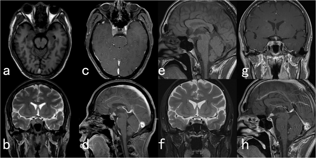 崔亚辉副主任医师:下丘脑