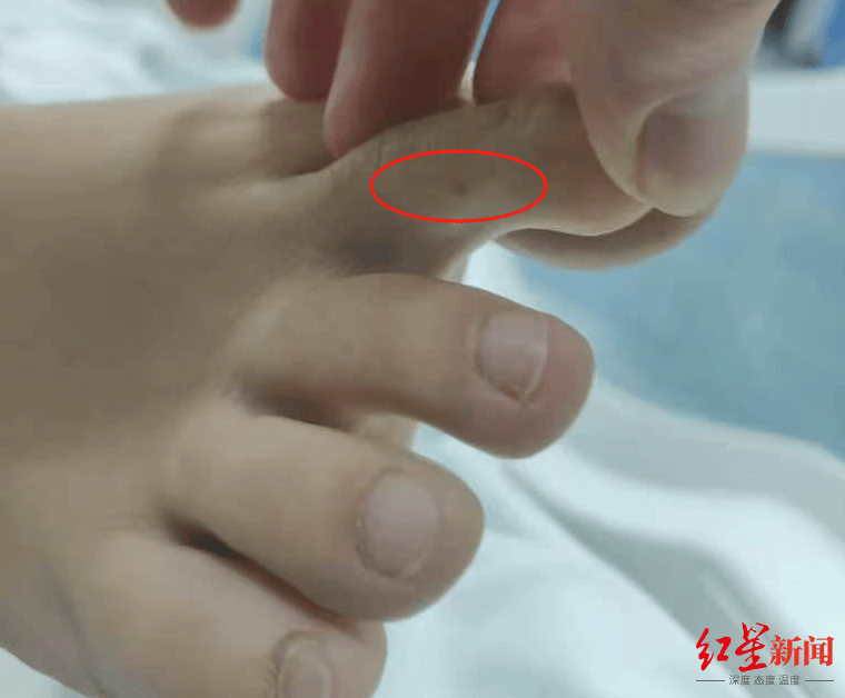 官方介入查询“27岁女子三亚旅游疑被不明物咬伤身亡”事情 家族
�：未来有考虑尸检