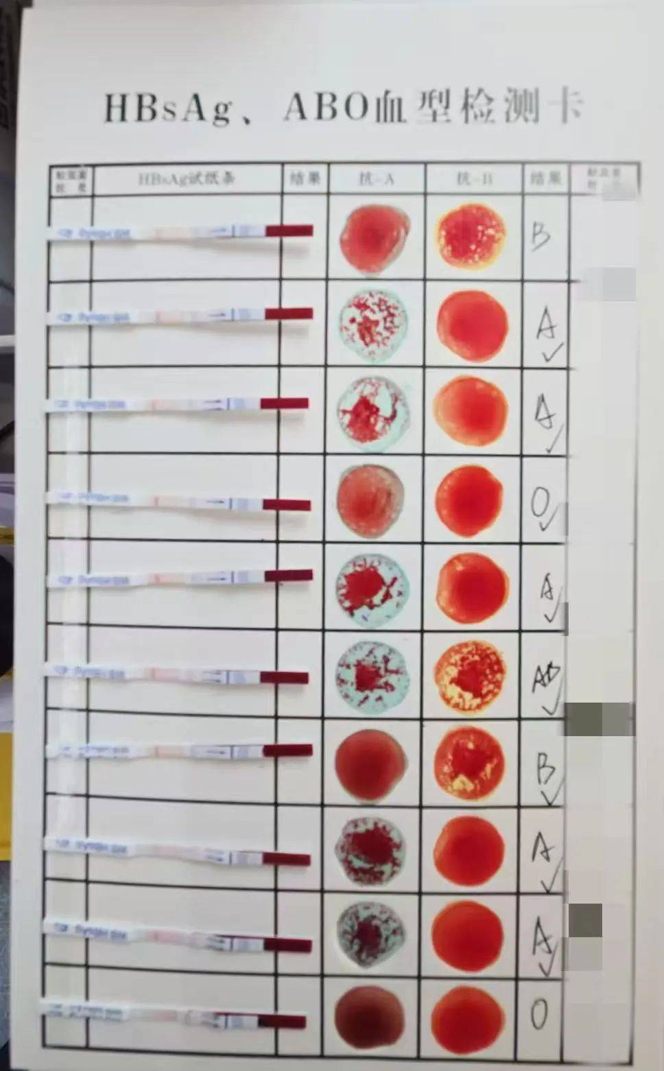 abo血型系统依据红细胞表面是否有a,b抗原决定