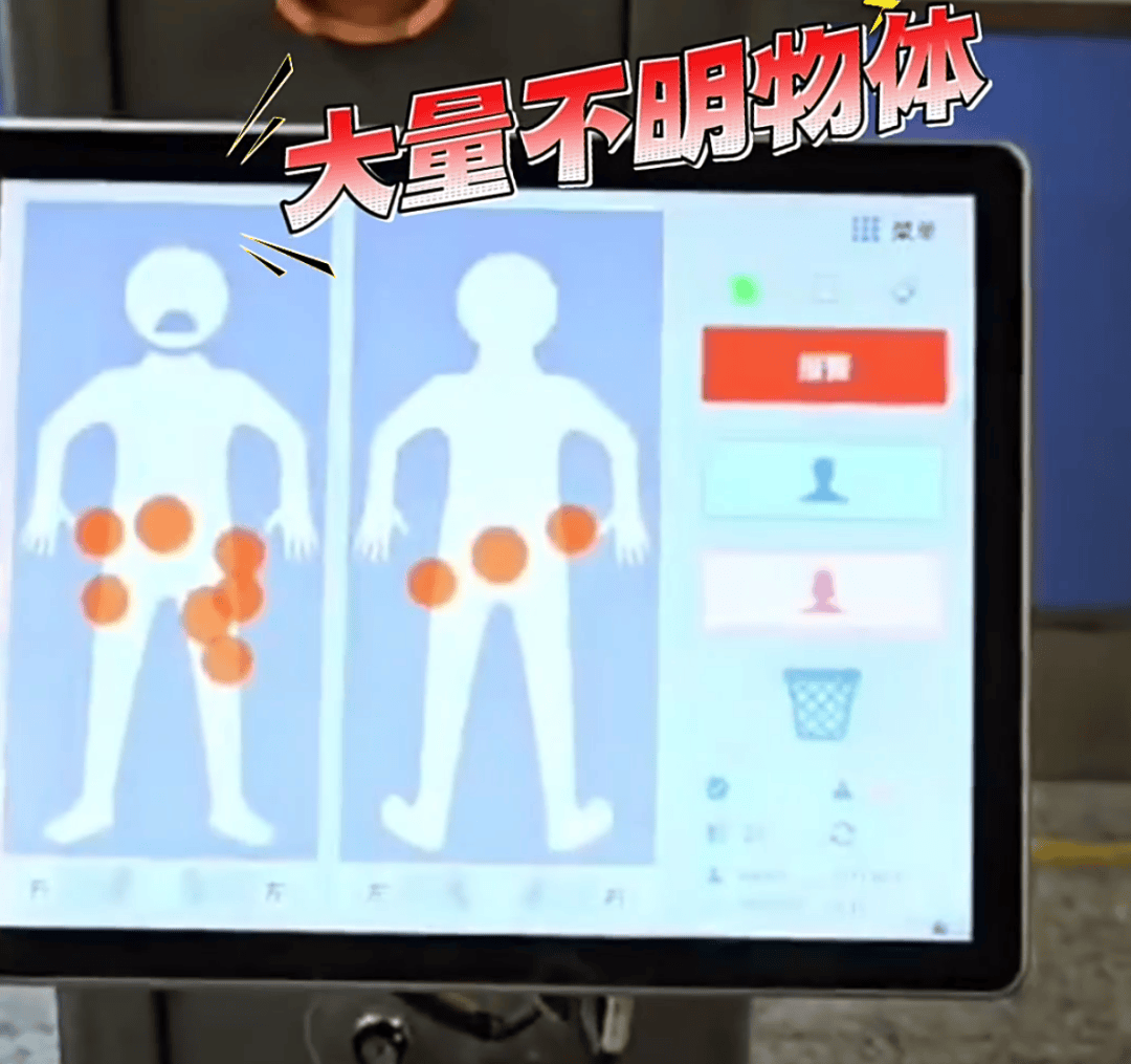 真“腰缠万贯”！小伙藏“袁大头”等265枚银元被当场拦截