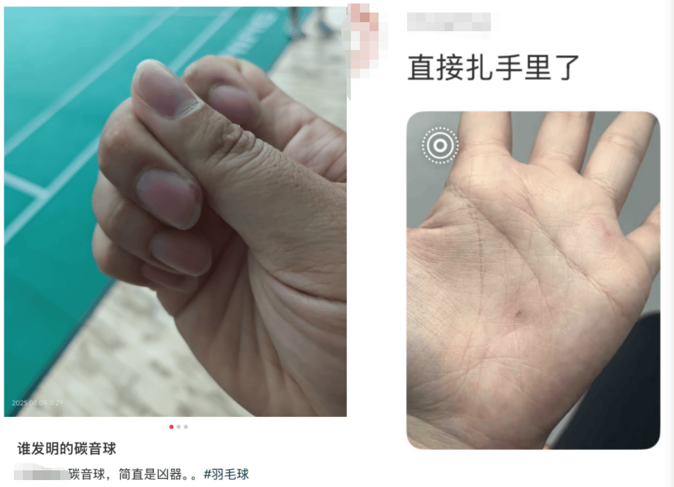 科普 | 击穿眉骨、扎穿手指……这项人气运动暗藏风险！