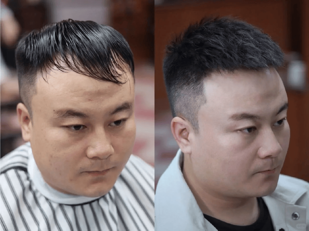 高额头,m型发际线男生福音发型来啦～ 这款短发很帅