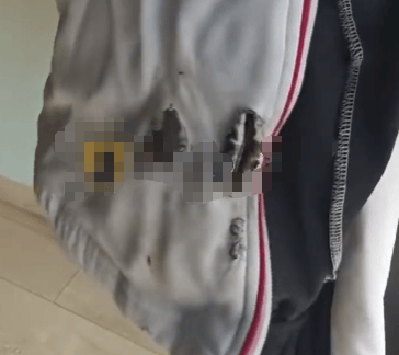 高中生散步时校服突发自燃？原是165元网购的“宝”在惹祸→