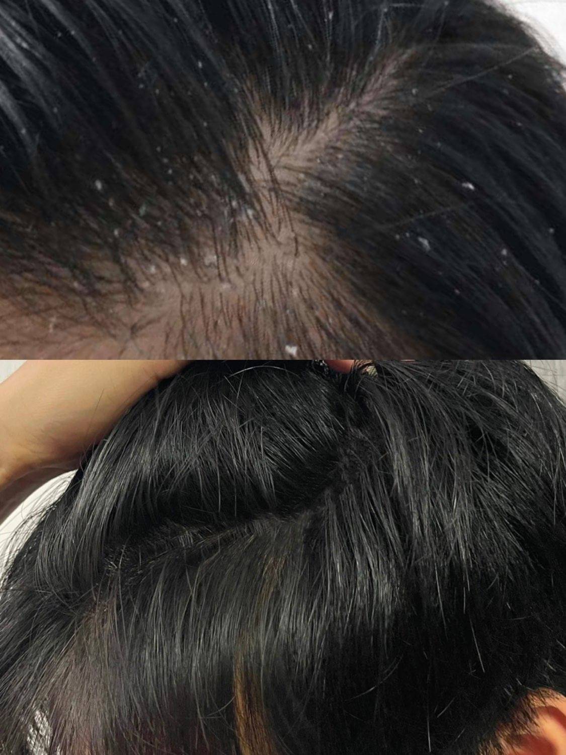 推荐二首迷滋养强韧洗发水这瓶首迷洗发水简直是脱发星人的救星挤