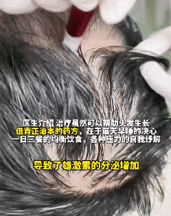 14岁女孩竟然全秃了？医生：这些习惯一定要改