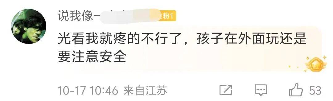 四川攀枝花一男童掉进烧烤店炭堆，全身烧伤！网友：光看就疼得不行