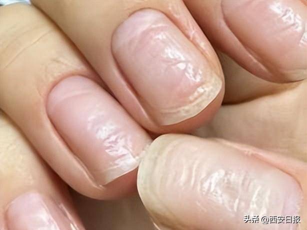 指甲有竖纹是肝不好？易断裂是缺钙？澄清6个指甲传言