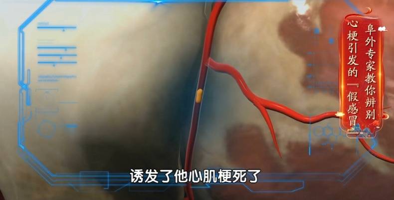 冬季心脏有4怕，个个都可能致命！