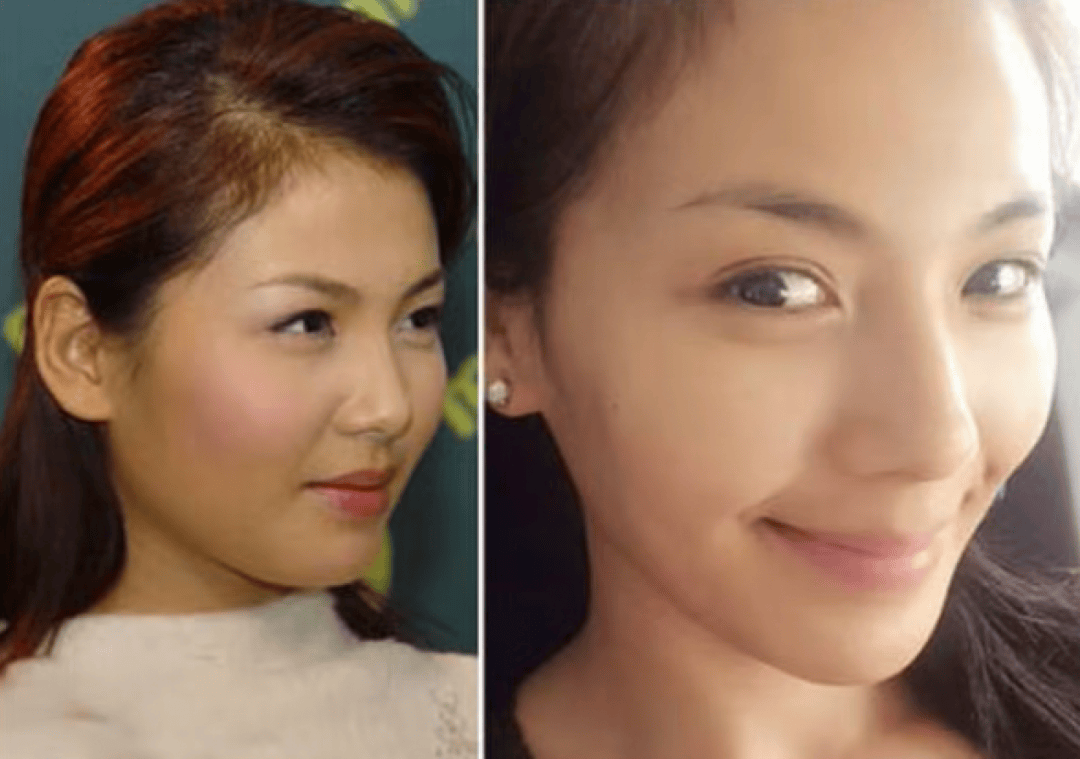 "瘦"出双眼皮啦⬇️刘涛婴儿肥没了原来李冰冰以前长这样啊⬇