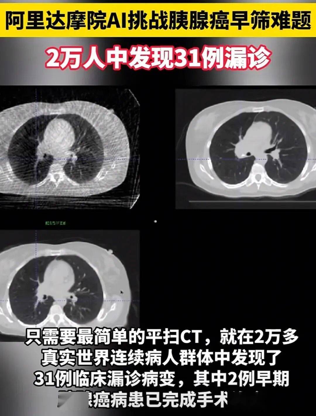 当美媒披露的应用该模型的全身ct扫描只需25美元时不少美国网友流下