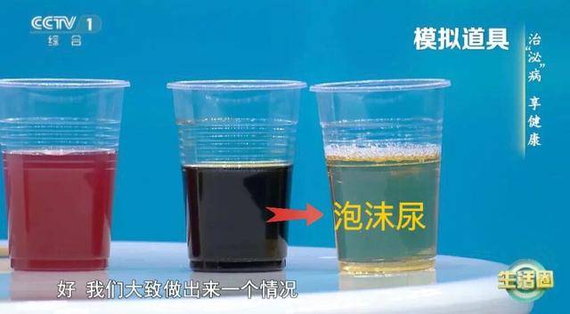 喝水后4个异常，可能是肾发出的“求救信号”！