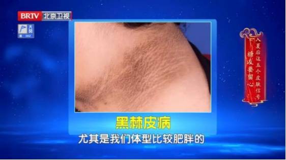 这些地方“洗不干净”？赶紧查这项指标