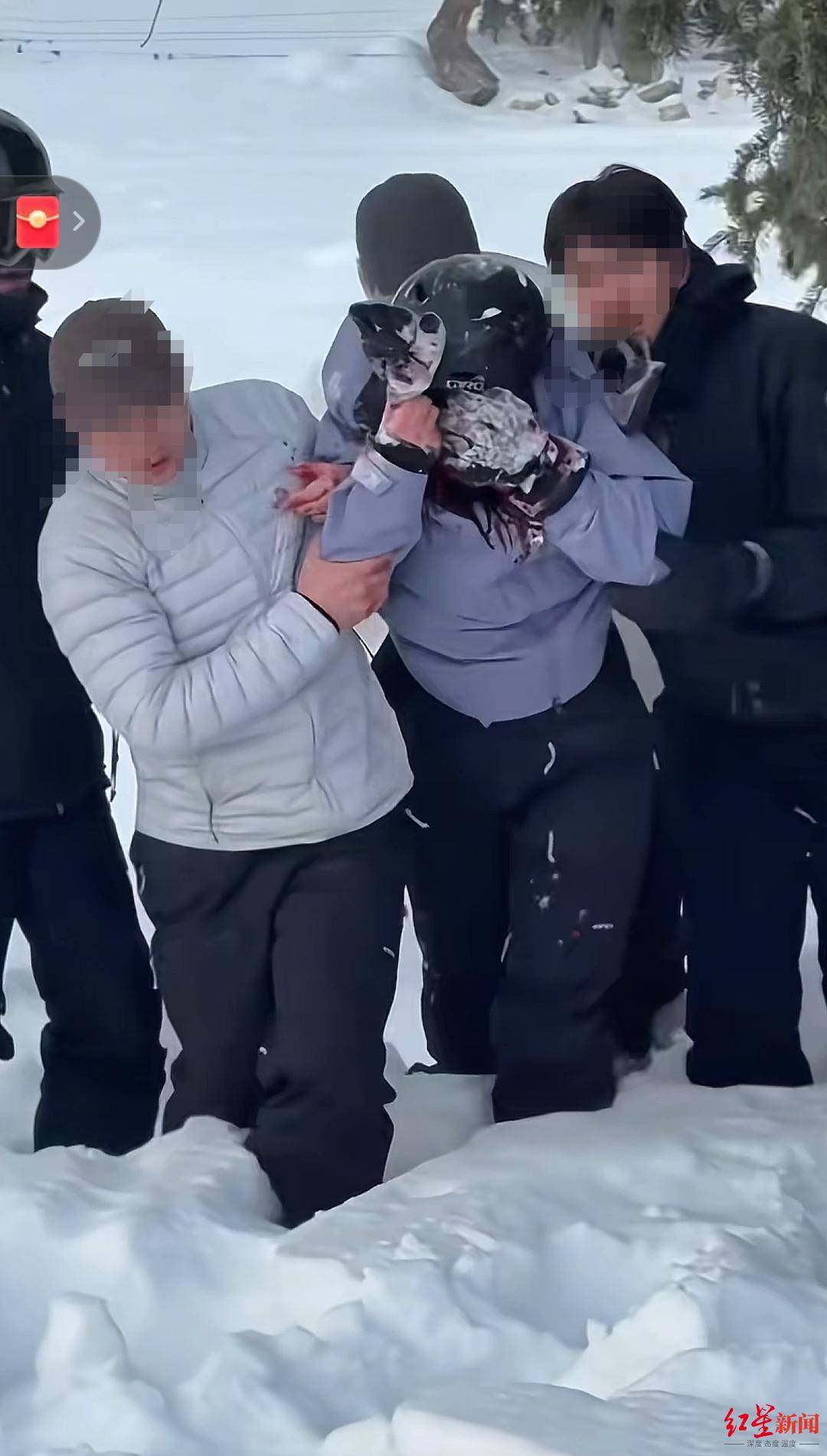 雪豹伤人事件续:伤者已从急诊转至其他科室 村支书称雪豹不常见,或因雪大缺食才下山