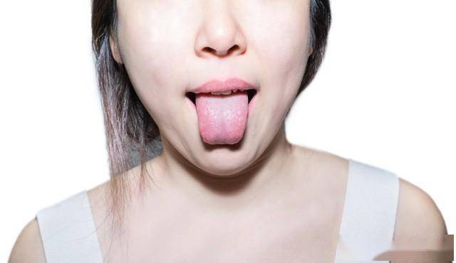 舌苔厚腻总不消，祛湿药吃了白搭？4大根源+对症方法，多人都忽视