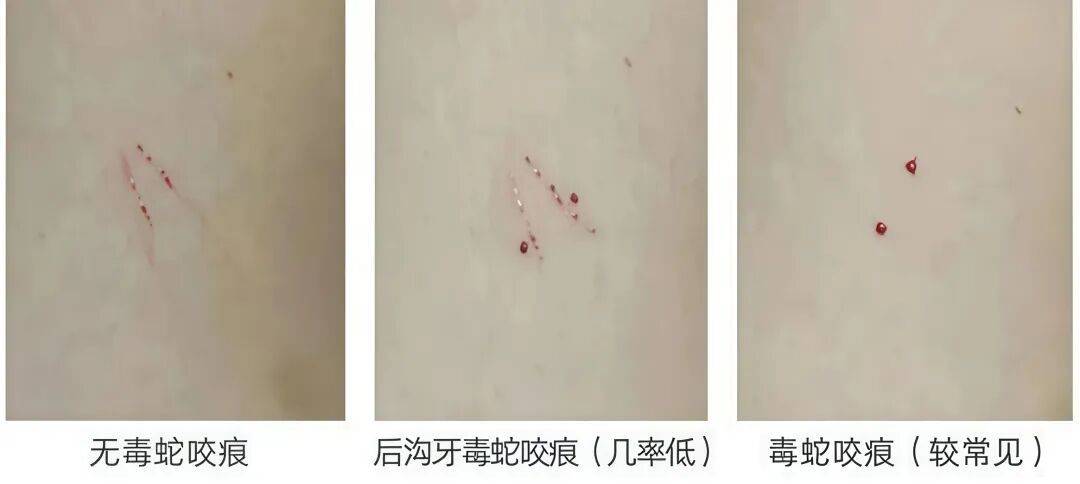 惊蛰到，蛇出没！深圳已有人被蛇咬！